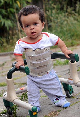 body brace.jpg